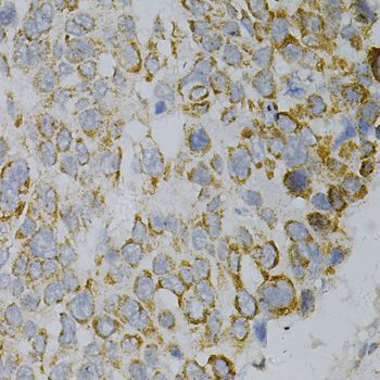 Immunohistochemistry - GNAO1 Antibody (144-02510)