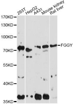 Western blot - FGGY antibody (144-014904)