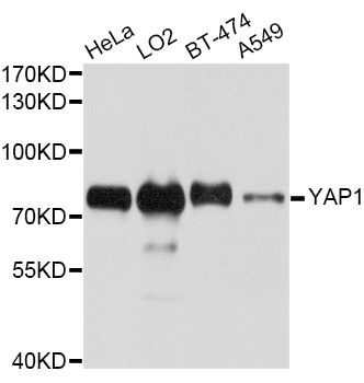 Western blot - [KO Validated] YAP1 Polyclonal Antibody (144-01002)