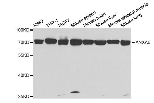 Western blot - ANXA6 Polyclonal Antibody (144-05390)