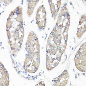 Immunohistochemistry - PTK2 Polyclonal Antibody (144-60065)