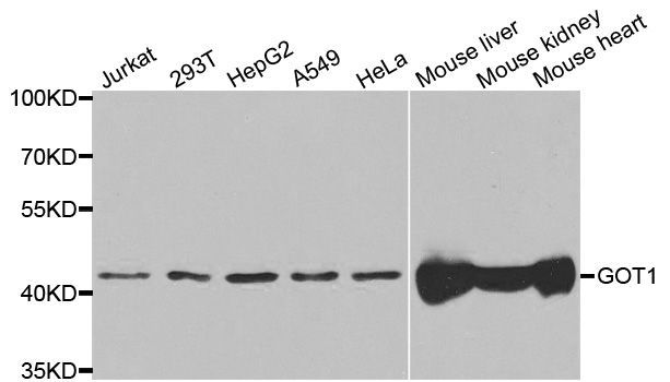 Western blot - GOT1 Polyclonal Antibody (144-05822)