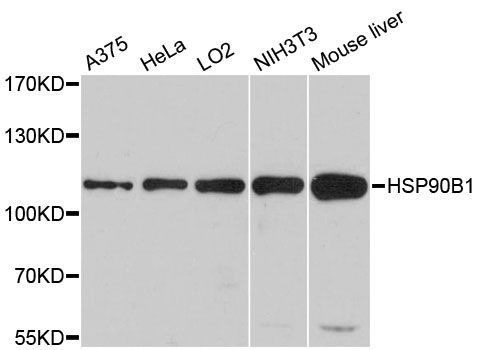 Western blot - HSP90B1 Polyclonal Antibody (144-00989)