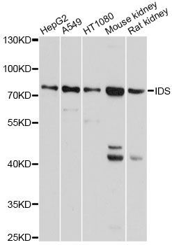 Western blot - IDS antibody (144-01857)
