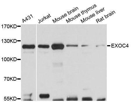 Western blot - EXOC4 antibody (144-012374)