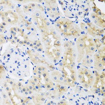 Immunohistochemistry - HNRNPL Polyclonal Antibody (144-08430)