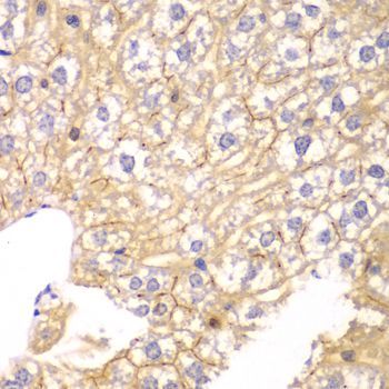 Immunohistochemistry - PPP2R2A antibody (144-02185)