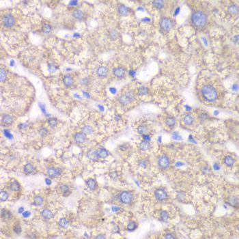 Immunohistochemistry - ACAT1 Polyclonal Antibody (144-60258)