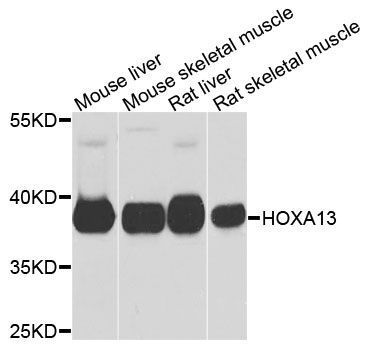 Western blot - HOXA13 Polyclonal Antibody (144-09822)