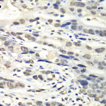 Western blot - [KO Validated] NUDT1 Polyclonal Antibody (144-60285)