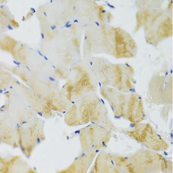 Immunohistochemistry - TRAP1 Antibody (144-02748)