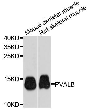 Western blot - PVALB antibody (144-60383)