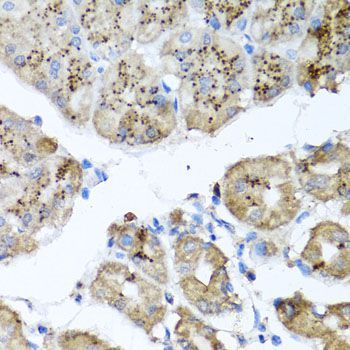 Immunohistochemistry - PPOX Polyclonal Antibody (144-06397)