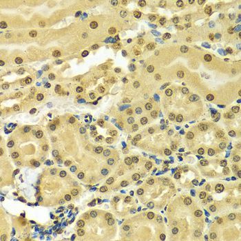 Immunohistochemistry - [KO Validated] HNRNPA2B1 Polyclonal Antibody (144-01162)