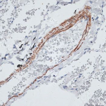 Immunohistochemistry - TPM1 antibody (144-01157)