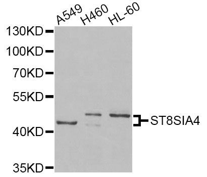 Western blot - ST8SIA4 Antibody (144-06754)