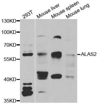 Western blot - ALAS2 antibody (144-06522)