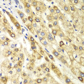 Immunohistochemistry - CTBP1 antibody (144-01707)