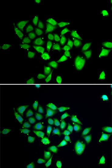Immunofluorescence - DPP8 antibody (144-07113)