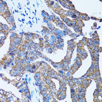 Immunohistochemistry - Caspase3 Polyclonal Antibody (144-60067)