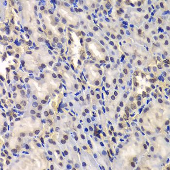 Immunohistochemistry - DDX41 Polyclonal Antibody (144-06576)