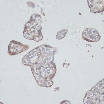 Immunohistochemistry - TFRC antibody (144-05865)