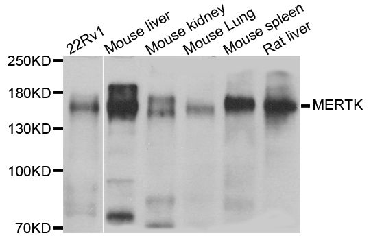 Western blot - MERTK antibody (144-05443)