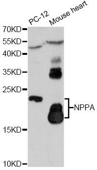 Western blot - NPPA antibody (144-60779)