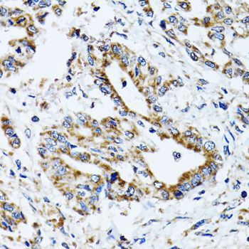 Immunohistochemistry - ATP5B Polyclonal Antibody (144-05769)