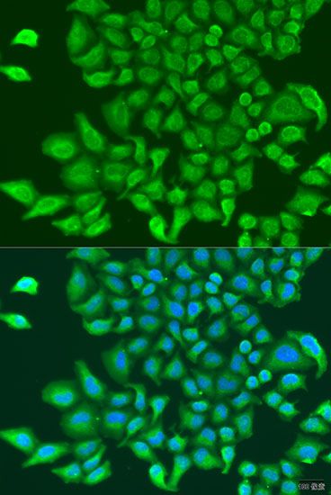 Immunofluorescence - TUBGCP3 antibody (144-04417)