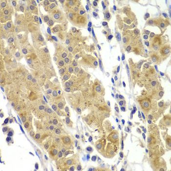Immunohistochemistry - MMP14 antibody (144-02549)