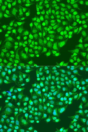 Immunohistochemistry - [KO Validated] ITGA2 Polyclonal Antibody (144-07629)