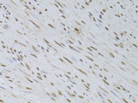 Immunohistochemistry - HDGFRP3 antibody (144-08815)