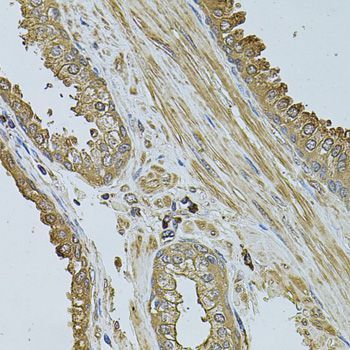 Immunohistochemistry - MYLIP antibody (144-06166)