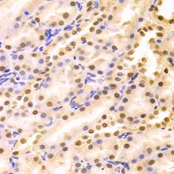 Immunohistochemistry - HDGF Antibody (144-05347)