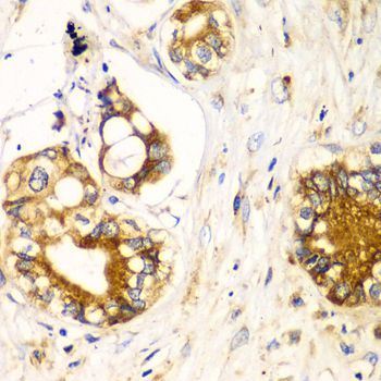 Immunohistochemistry - RPN1 antibody (144-06726)