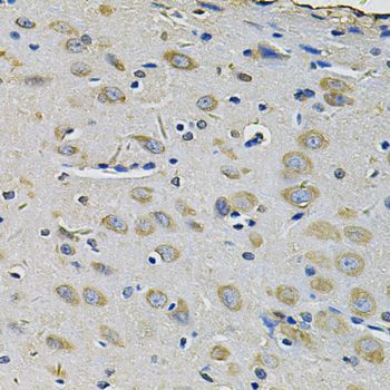 Immunohistochemistry - RAB17 Antibody (144-07831)