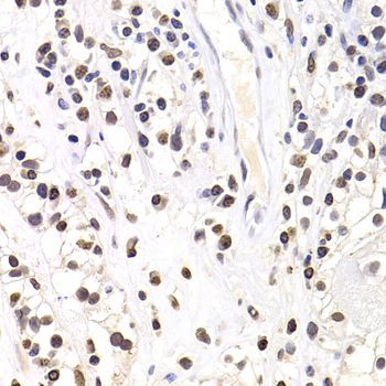 Immunohistochemistry - SOX5 Polyclonal Antibody (144-06985)