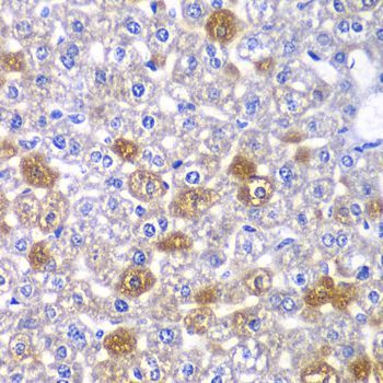 Immunohistochemistry - MYO1C Polyclonal Antibody (144-06936)