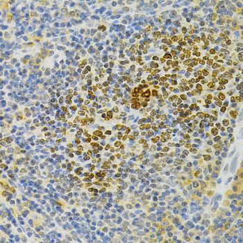 Immunohistochemistry - TNFRSF11B Polyclonal Antibody (144-02100)