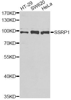 Western blot - SSRP1 Polyclonal Antibody (144-06413)