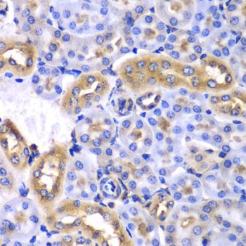 Immunohistochemistry - SYNCRIP Polyclonal Antibody (144-07219)