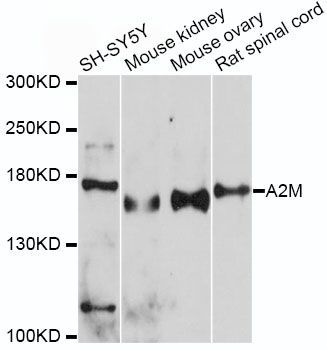 Western blot - A2M Polyclonal Antibody (144-01573)