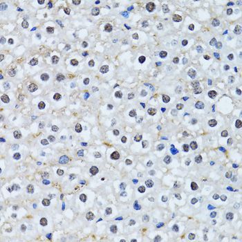 Immunohistochemistry - HIST2H2BE antibody (144-01958)