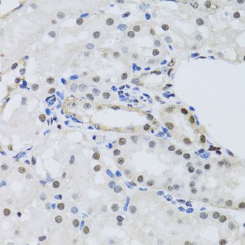 Immunohistochemistry - PRPF19 antibody (144-06706)