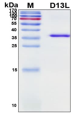 SDS-PAGE Image