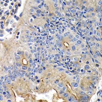 Immunohistochemistry - PTGIR Polyclonal Antibody (144-01849)
