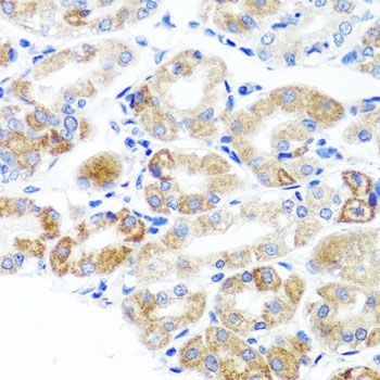 Immunohistochemistry - DLG1 antibody (144-08542)