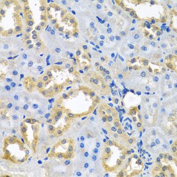 Immunohistochemistry - NDUFB10 Polyclonal Antibody (144-03982)