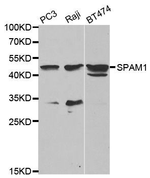 Western blot - SPAM1 antibody (144-02120)